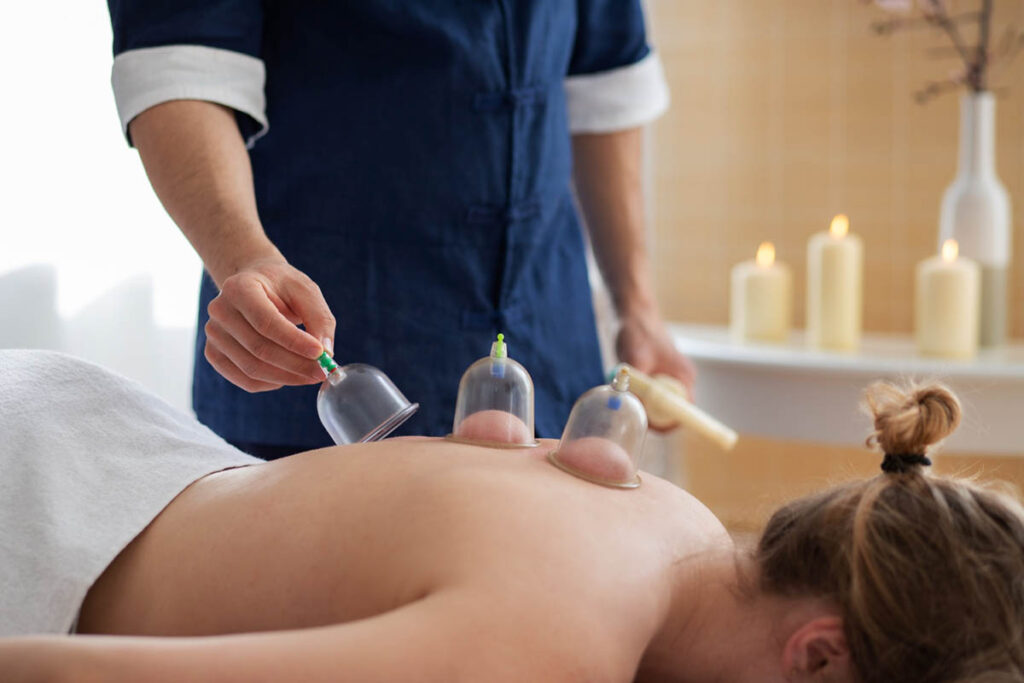 Dry Needling vs Cupping Which Is Best for You