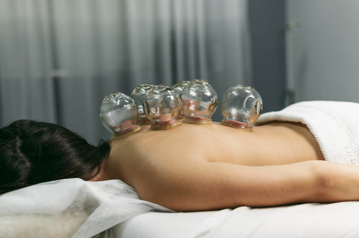 Cupping After a Workout Benefits and Considerations